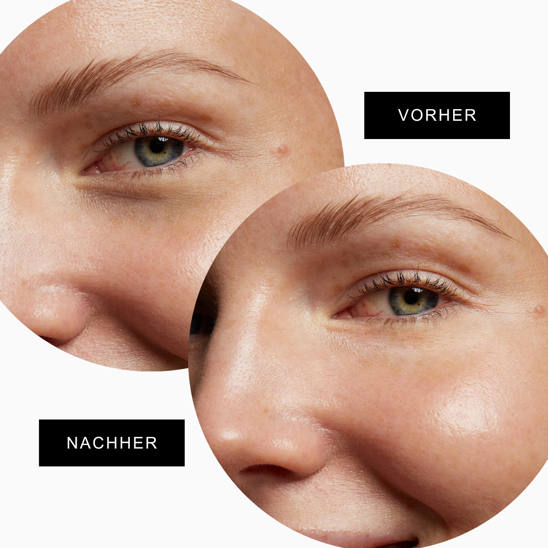 Close-up der Ekobrennde Augenpads mit Vitamin E für intensive Feuchtigkeit und Pflege.