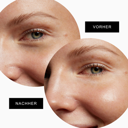 Nahaufnahme der Everlasting Eye Pads, ideal für die ökologische Augenpflege und Faltenreduktion.