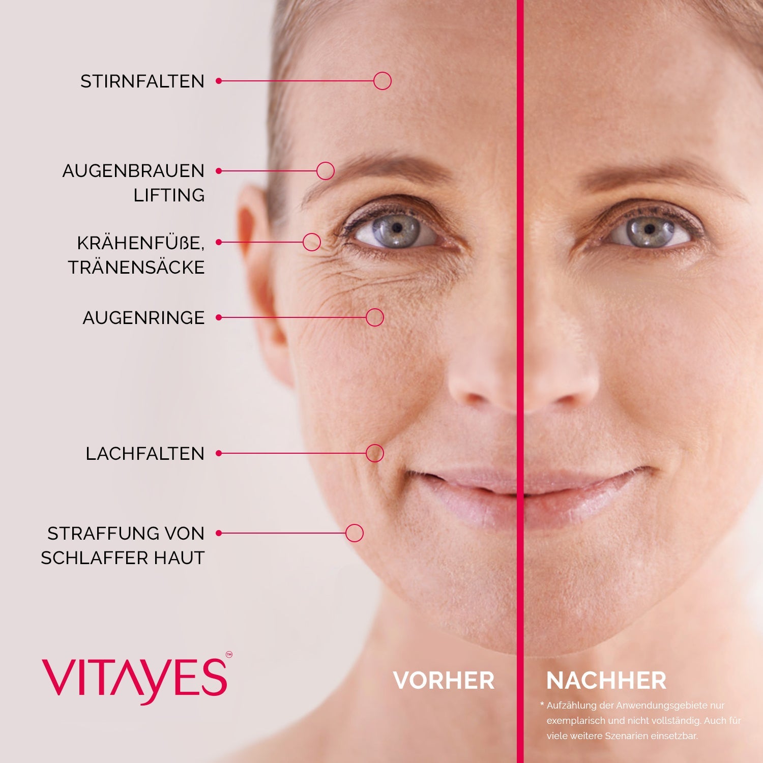 Anwendung der Instant Ageback-Creme: sanfte Massage auf dem Gesicht für straffere Haut.