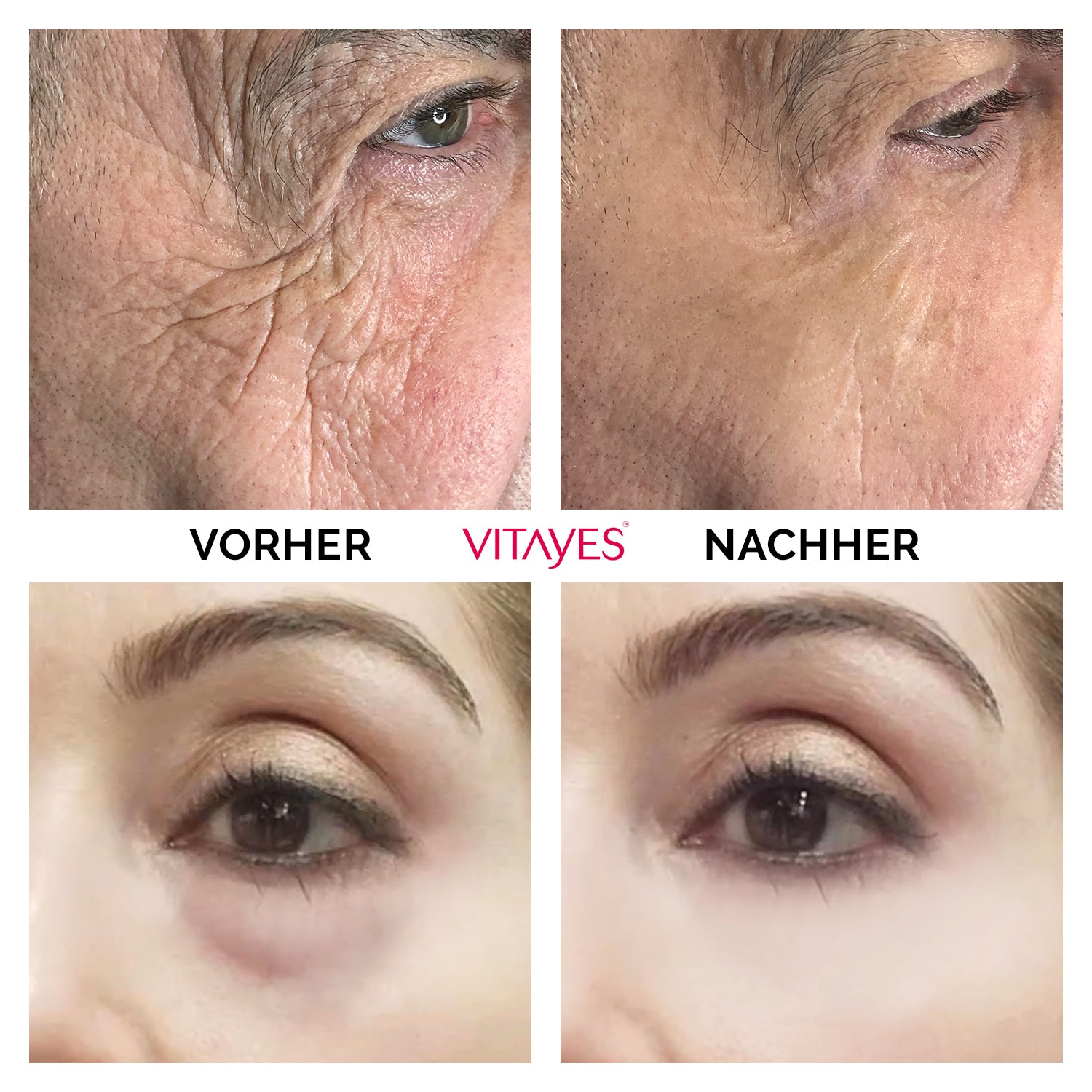 Verpackung der Lifting-Creme zeigt natürliche Inhaltsstoffe für effektives Anti-Aging.