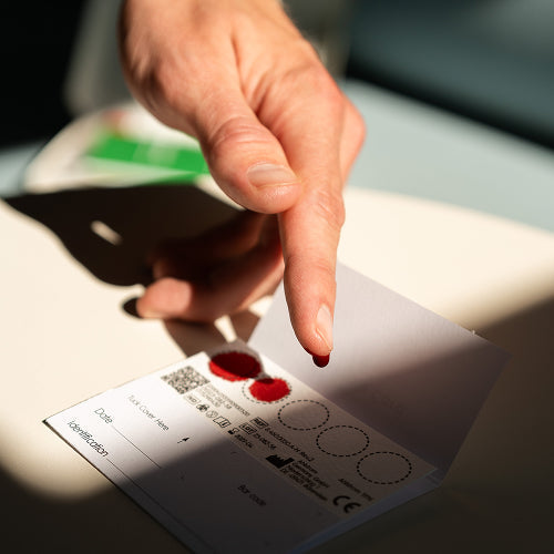 Hämoglobin Test