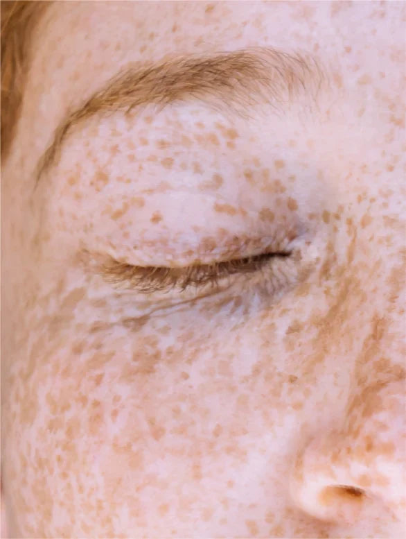Praktische Pipette zum präzisen Dosieren des Vitamin C Serums von ekovita.