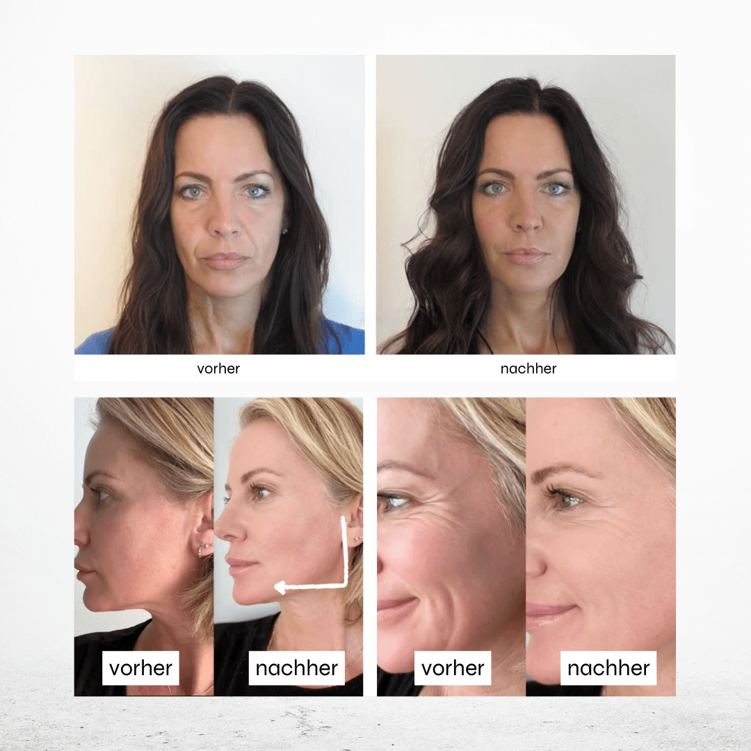 Hyaluron Maske •Anti Age• mit Lotusextrakt