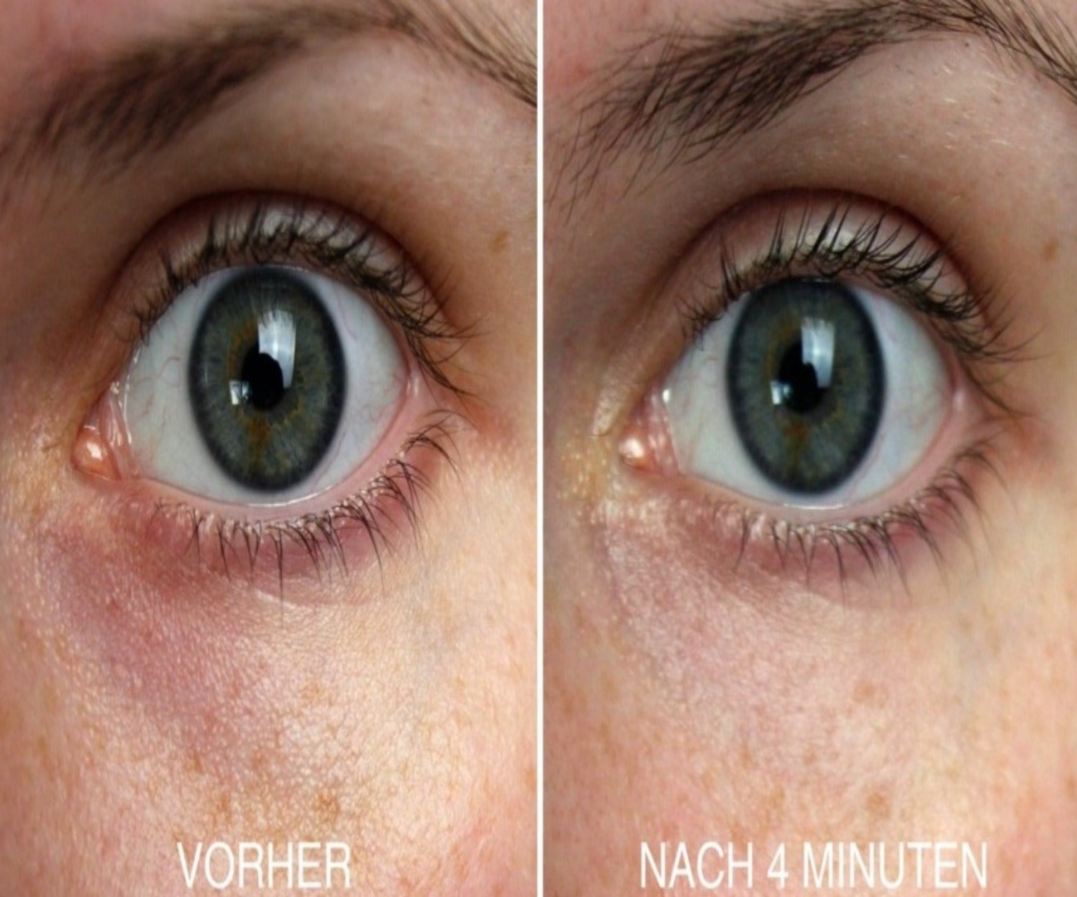 Anwendung des Anti-Falten Pflege Serums um die Augen für eine strahlende, gesunde Haut.