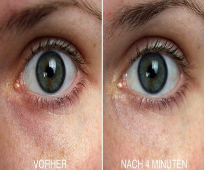 Anwendung des Anti-Falten Pflege Serums um die Augen für eine strahlende, gesunde Haut.